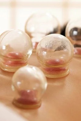 الحجامة الجافة والمتزحلقة